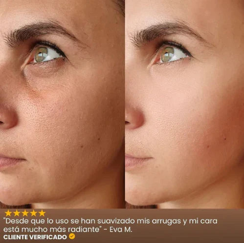 INFIBELLA®️ - Reduce líneas de expresión, arrugas y luce joven